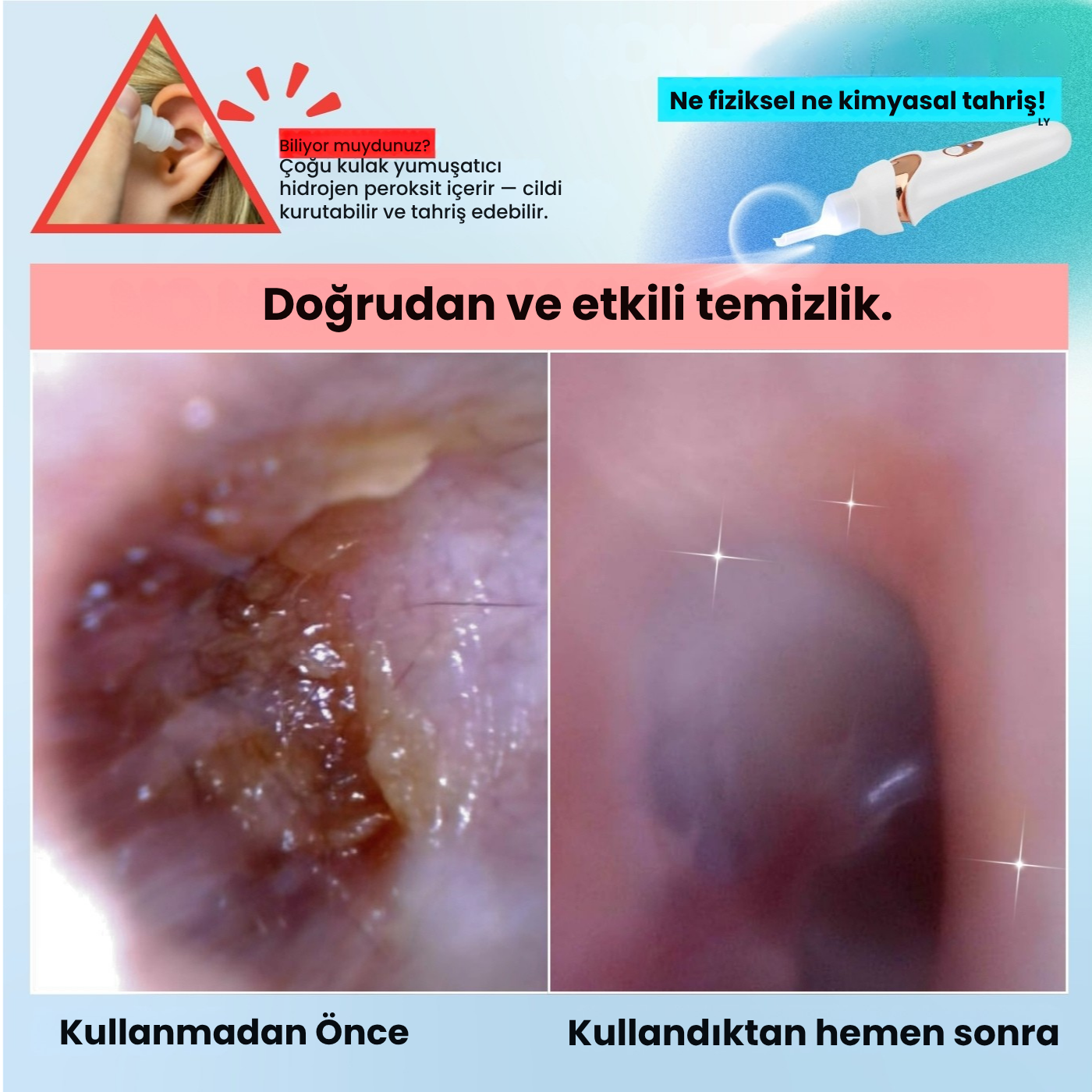 EARVAKO Vakumlu Kulak Temizleyici