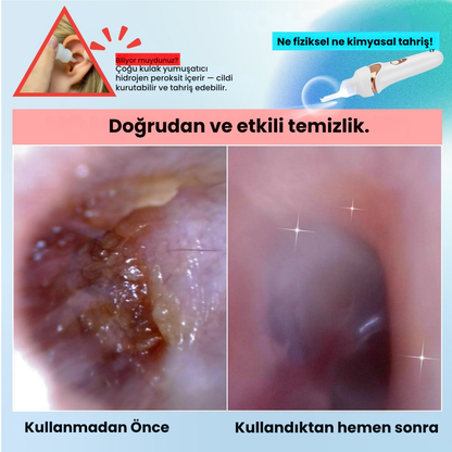 EARVAKO Vakumlu Kulak Temizleyici